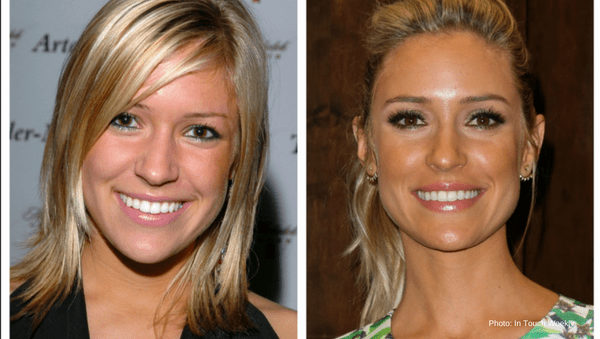 Kristin Cavallari Then Now A Deep Dive Into The Evolution Of Kristin Cavallari