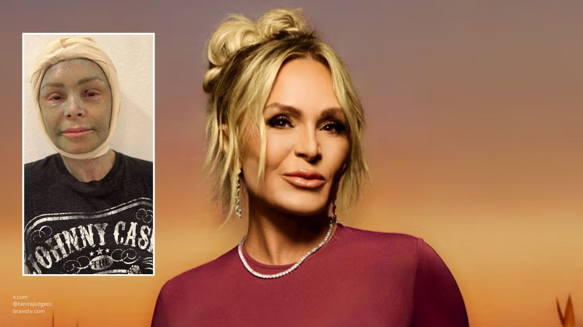 tamra judge face surgery bill comp rhoc two ts in a pod live