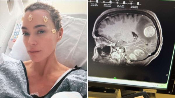 Teddi Mellencamp Brain Cancer Update