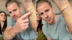 Sean Lowe Dog Attack The Bachelor
