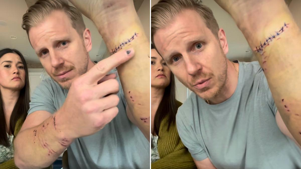 Sean Lowe Dog Attack The Bachelor