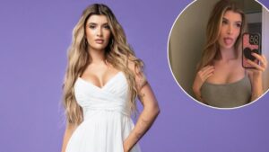 sami sheen implants