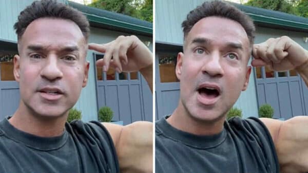Mike ‘The Situation’ Sorrentino Facelift Allegations