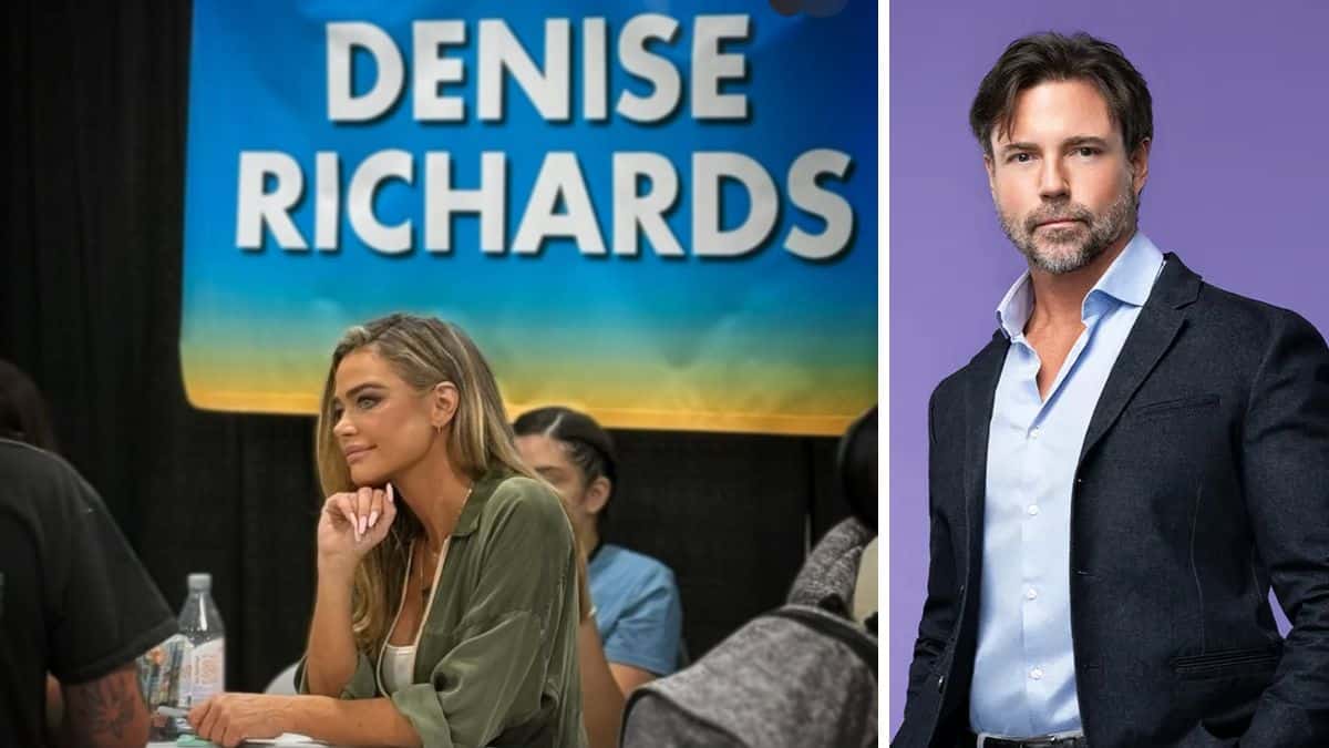 Aaron Denise bruises easily