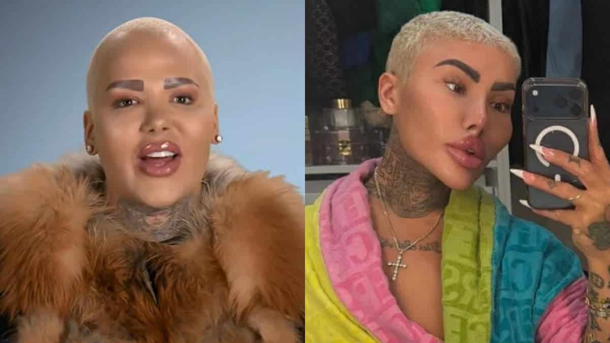 Botched Star Jordan James Parke Dead at 34 Following Possible Cosmetic  Procedure - Taste of Reality