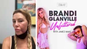 Brandi Glanville Graphically Described A New Health Issue – Content Warning