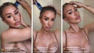 Shekinah hair loss