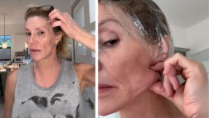 Brandi Glanville fungus