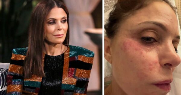 Bethenny Frankel infection