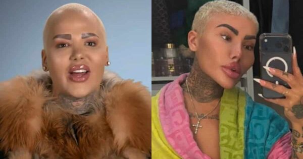 Botched Jordan James Parke Death