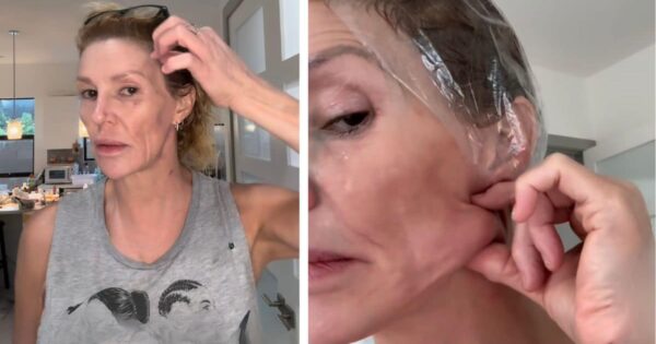 Brandi Glanville fungus